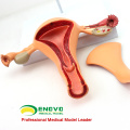 VENDER 12442 Estructura uterina Anatomical Model Anatomy Reproductive System